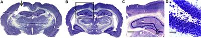 Chronic Bumetanide Infusion Alters Young Neuron Morphology in the Dentate Gyrus Without Affecting Contextual Fear Memory